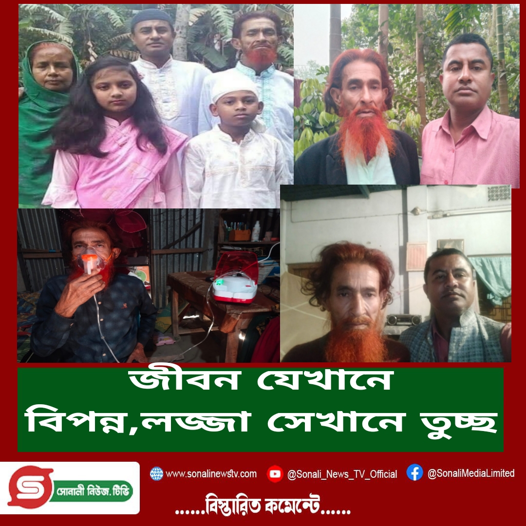 জীবন যেখানে বিপন্ন,লজ্জা সেখানে তুচ্ছ।