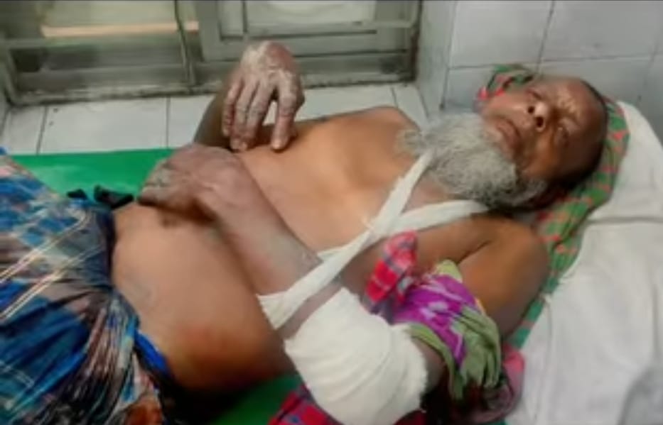 কচুয়ায় জমি নিয়ে বিরোধ: ছেলের হামলায় পিতা ও ভাই গুরুতর আহত