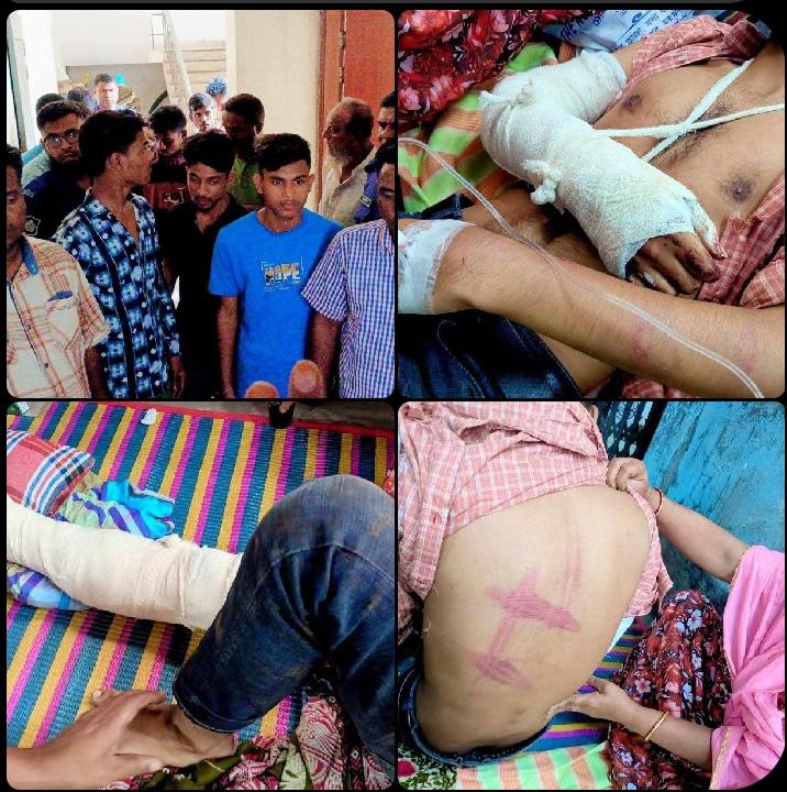 ডিবিএল ফ্যাক্টরির শ্রমিককে জিম্মি করে মা/র/ধ/র ও চাঁ/দা দাবির অভিযোগে ৫ জন কে আ/টক করেছে পুলিশ।