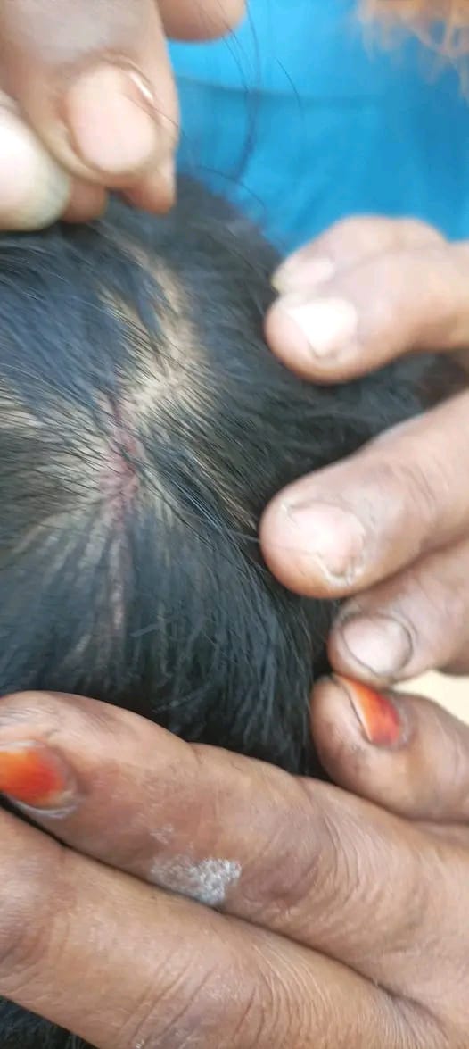 লামার সরইয়ের কুতুবদিয়া পাড়ায় শিশু নির্যাতনের অভিযোগ উঠেছে শিক্ষকের বিরুদ্ধে