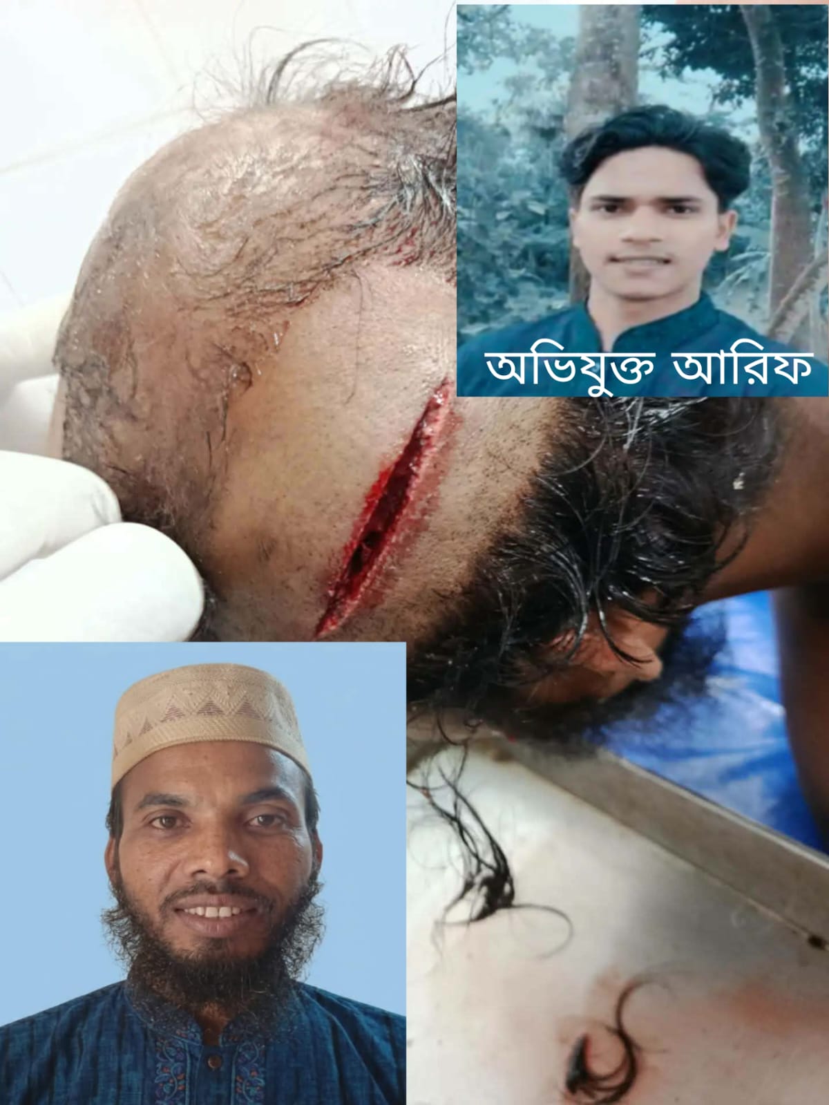 বেতাগীতে শিশুদের খেলার জমি নিয়ে অভিভাবকদের মধ্যে মারামারি আহত ২